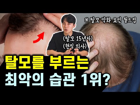 탈모에 가장 치명적인 습관 & 원인 3가지 (의사가 말하는 탈모 유발 원인 밸런스게임)