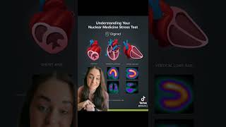 Nuclear Medicine Exams Explained Myocardial Perfusion Mibi