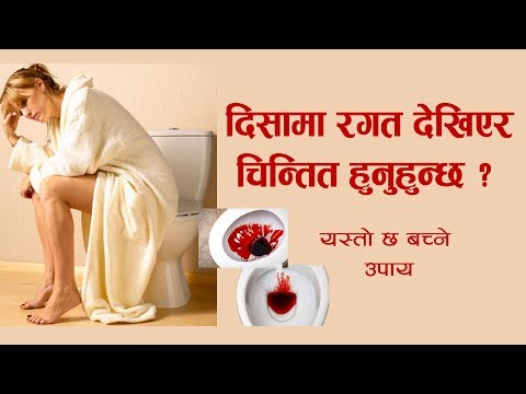 दिसामा रगत देखियो : ठुलो आन्द्राको क्यान्सर पनि हुनसक्छ - Dr. Bhupendra Kumar Basnet | Hamro Doctor