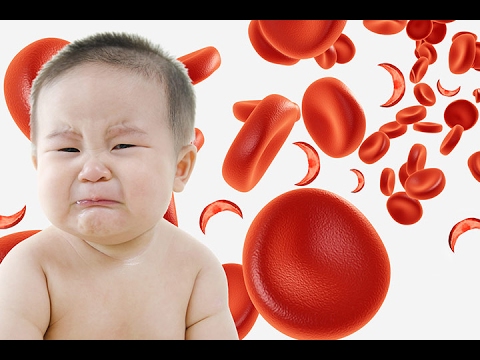 Ang bata ay may isang halamang-singaw sa katawan kaysa sa pagalingin Tsino gamot para sa kuko halamang-singaw