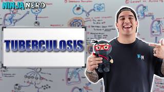 Tuberculosis | Clinical Medicine