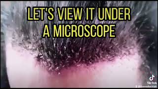 Download lagu Lice under the microscope #kuto #liceinfestation mp3