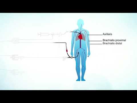 3 PulsioFlex PiCCO EN140225