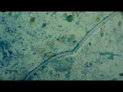 Parazita rókagomba tinktúra vélemények