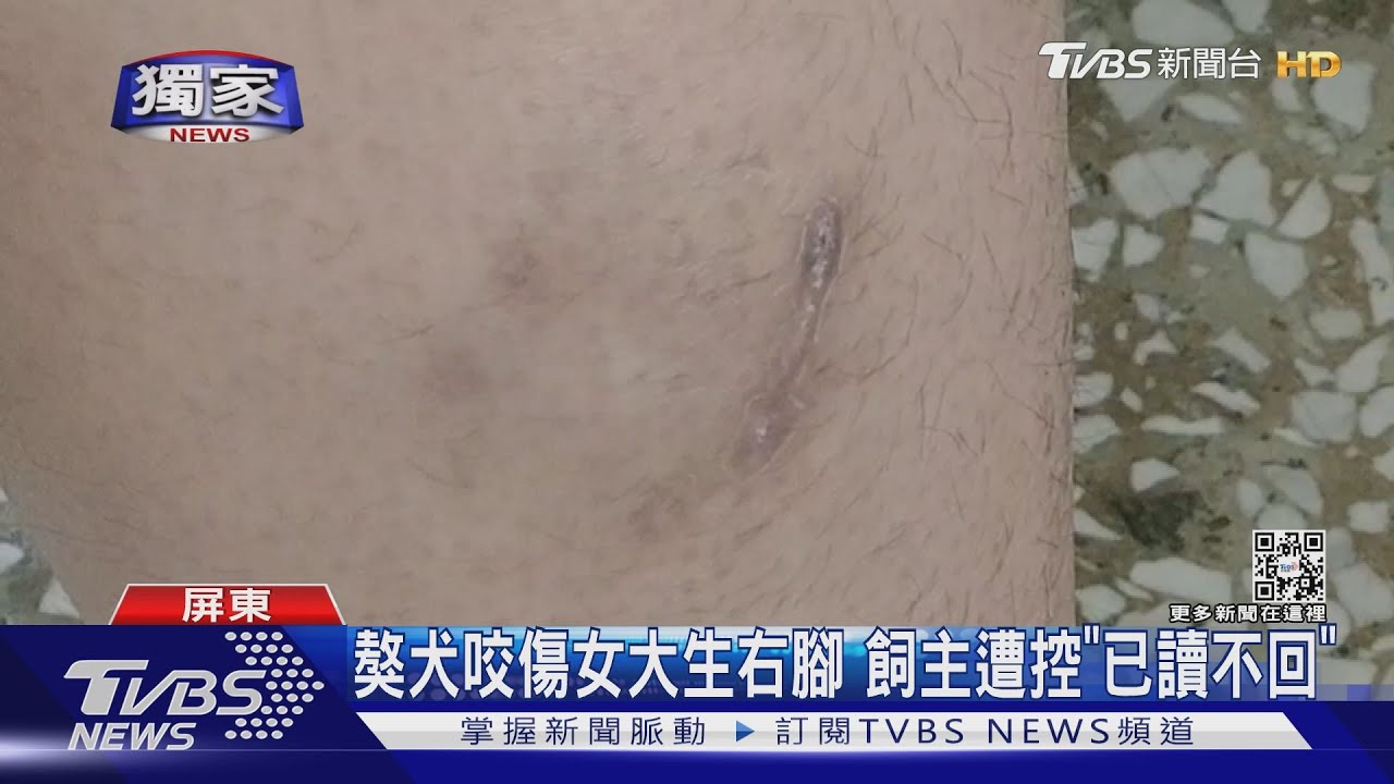 獒犬咬傷女大生!賠償談不攏要調解 飼主遭控「已讀不回」