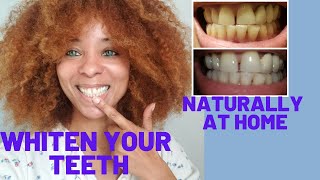 Whiten Your Teeth At Home –Instant Results–