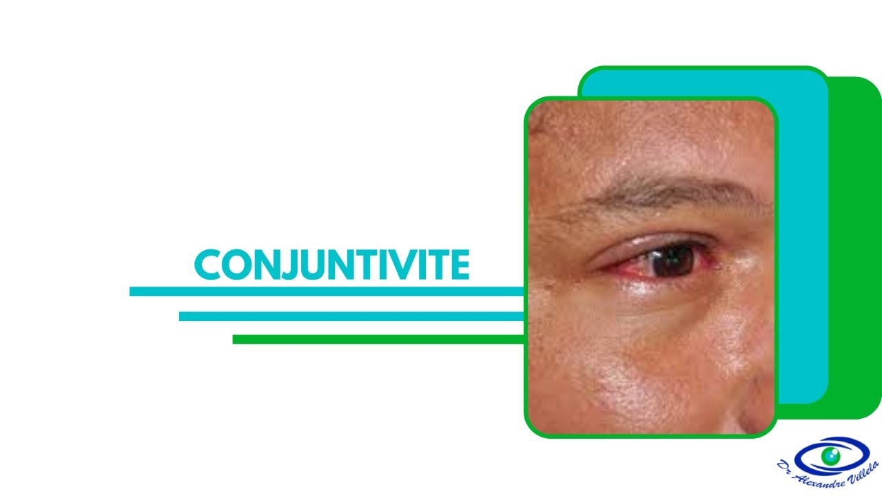 Alexandre Nogueira Villela Salgado-13