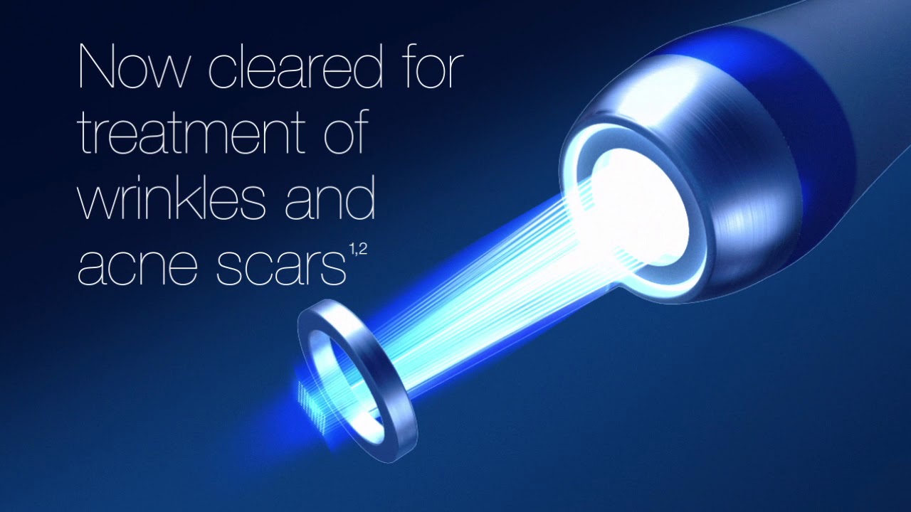 PicoWay® treatment