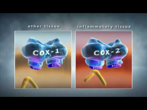 Unilateral prostate enlargement