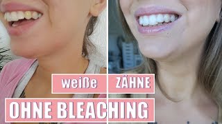 Professionelle Zahnreinigung für zu Hause? Silk’n Toothwave Zahnbürste Test