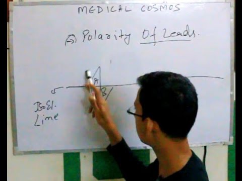 ECG/EKG CARDIAC AXIS PART 2 - ECG Vector and Polarity Concepts