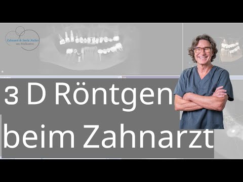 3 D Röntgen beim Zahnarzt - DVT - Implantatversorgung