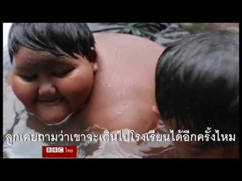 เลี้ยงลูกด้วยนมครีม clotrimazole เส้นรอบวงขนาดใหญ่หน้าอกเล็ก