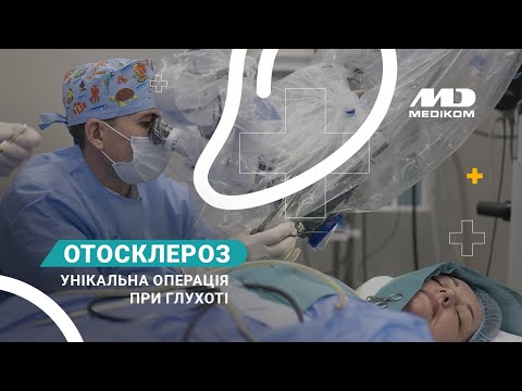 Операция Стапедопластика - відео