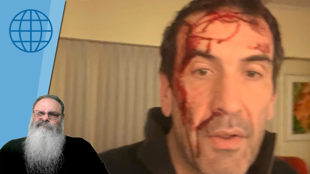 CANDIDATO ao SENADO na ARGENTINA é AGREDIDO e SOFRE TENTATIVA de HOMICÍDIO às VÉSPERAS da ELEIÇÃO