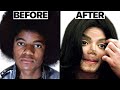 Michael Jackson Nose Job Plastic Surgeries - Surgeon Reacts DEFAULT Thumbnail
