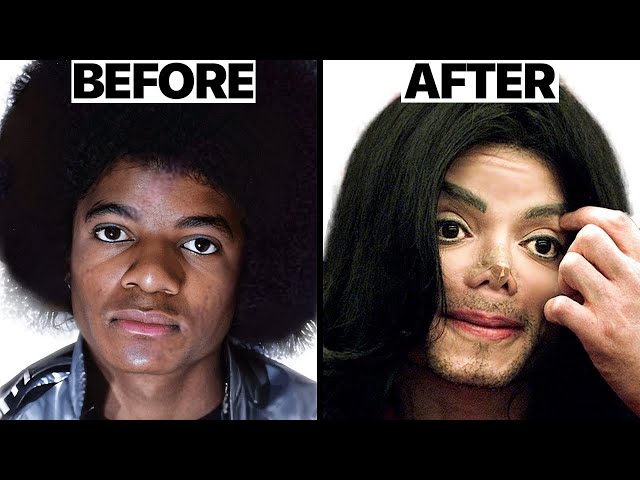 Michael Jackson Nose Job Plastic Surgeries - Surgeon Reacts SDDEFAULT Thumbnail