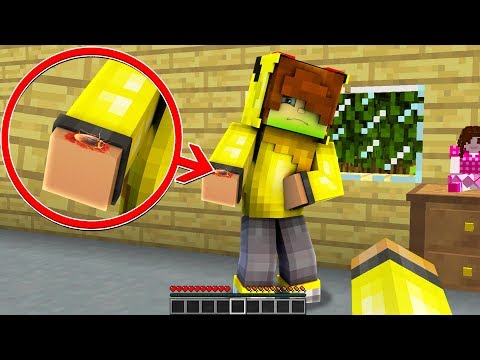 Ismetrgyİ Zehİrlİ BÖcek Isirdi 😱 Minecraft