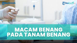 Macam-macam Benang yang Digunakan Pada Tarik dan Tanam Benang