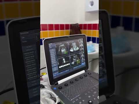 LAGOVERDENSE DE CORAÇÃO