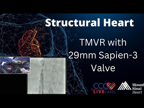 TAVR with 23mm Sapien-3 - November 2017