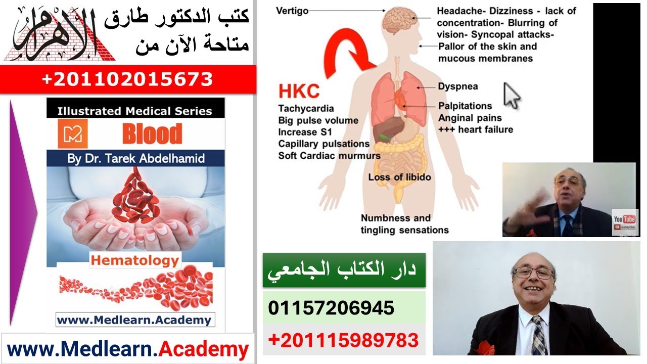 General Manifestations of Anemia  #cme #internal_medicine #medical #usmle #محاضرات_باطنة #USMLE