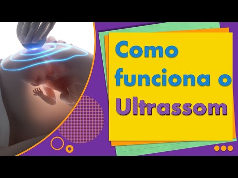 How ultrasound works