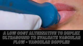 A Low Cost Alternative To Duplex Ultrasound To Evaluate Vascular Flow - Vascular Doppler