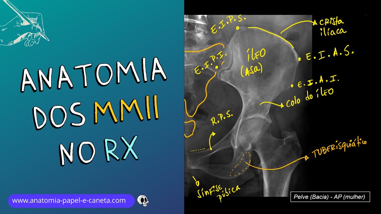 Anatomia Radiológica dos MMII | Como reconhecer Fraturas ou Luxações no RX