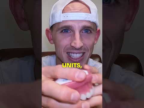 How to FIX Your OVERBITE as an Adult..