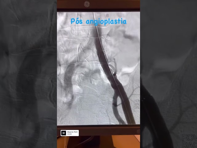 Vídeo