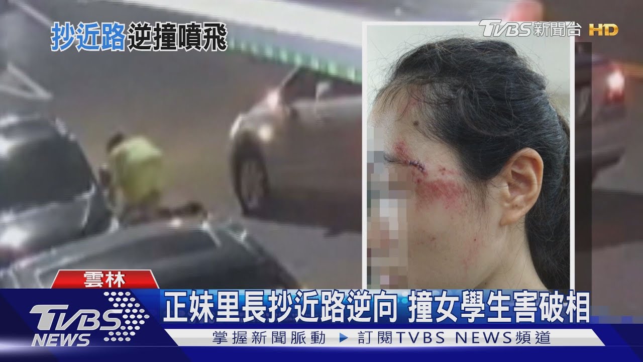 正妹里長抄近路逆向 撞女學生害破相