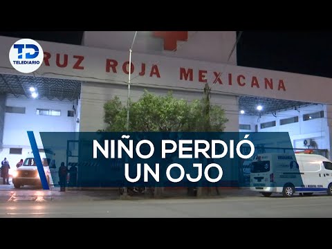 "Quiero a mi hijo", menor entre la vida y la muerte; fue golpeado y perdió un ojo