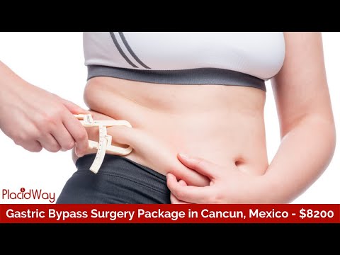 Most Popular Gastric Bypass Surgery in Cancun, Mexico Starts from $8200