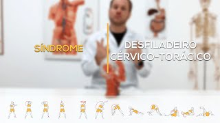 Síndrome do desfiladeiro cérvico-torácico