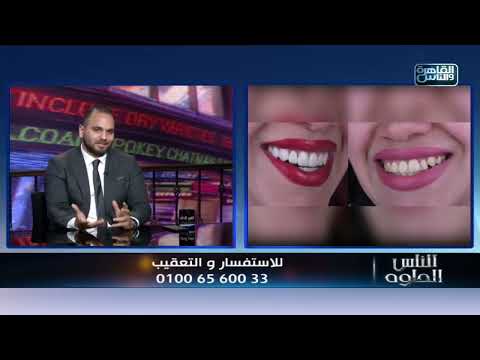 مقابلة — إعادة تأهيل الفكين