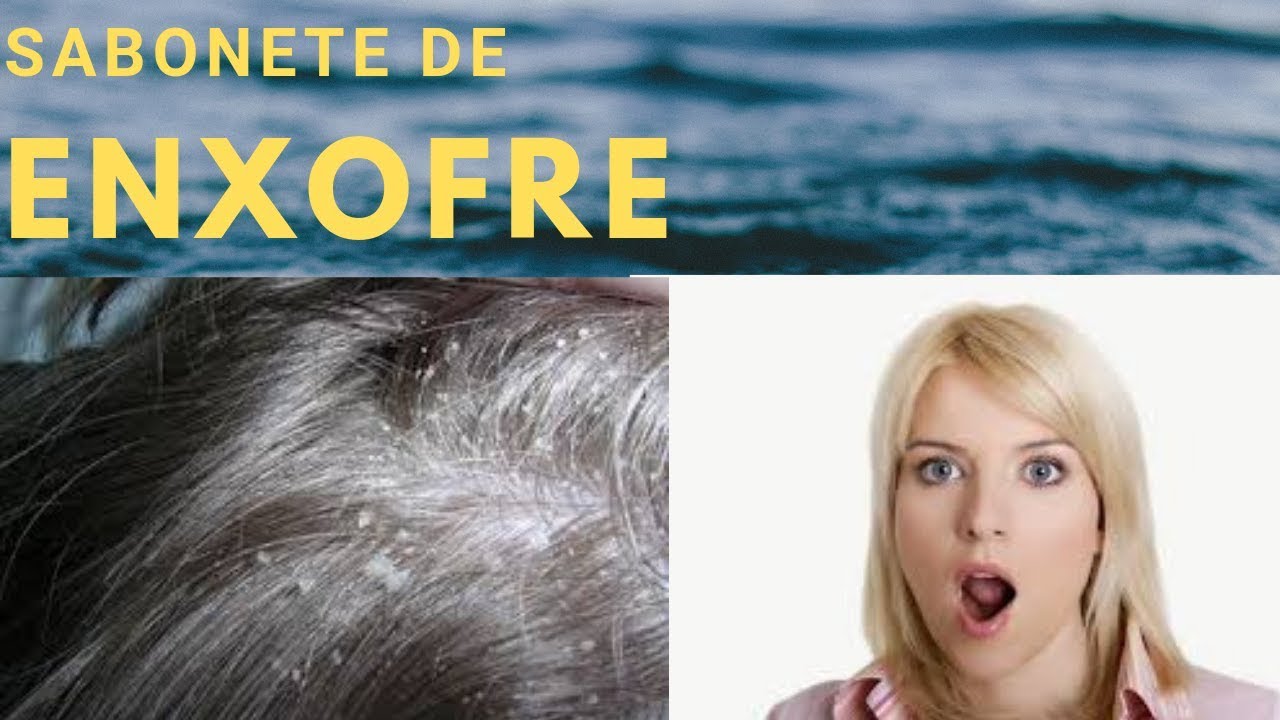 como eliminar as caspas com sabonete de enxofre
