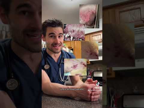 Immune Mediated Thrombocytopenia (ITP or IMT)