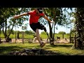 Testing Out My NEW Prosthetic Leg For The First Time