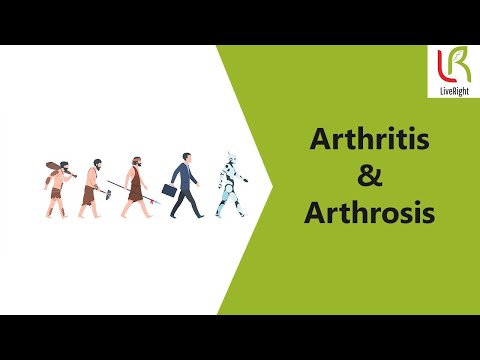 arthritis arthrosis injekciós kezelés)