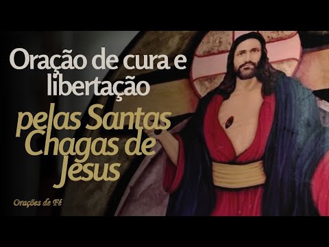 Oração de cura e libertação pelas Santas Chagas de Jesus