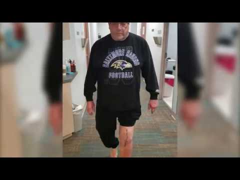 Watch knee replacement patient review