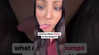 bumps on your tongue? 👅 #shorts