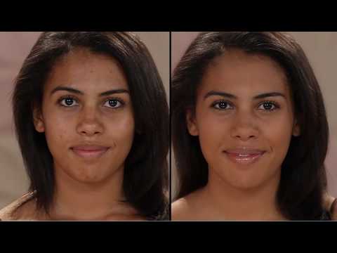 Il pigmentary nota su un dorso dopo abbronzatura di una fotografia La crema neotone da pigmentary nota risposte il prezzo