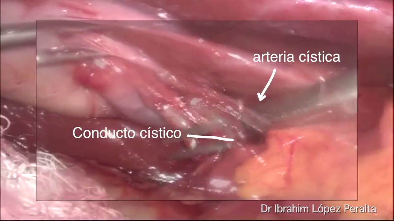 Ibrahim López Peralta-13