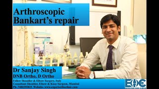 Arthroscopic Bankart’s Repair Surgery