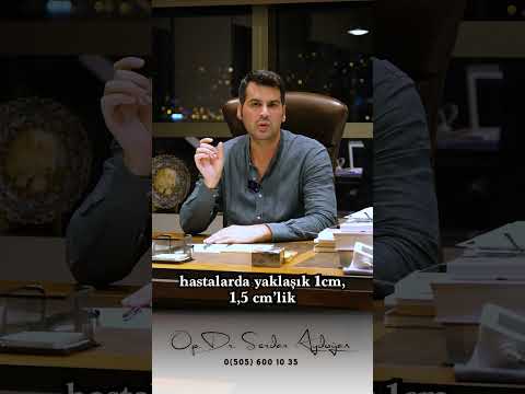 Are there any scars after sleeve gastrectomy?