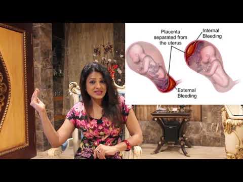 Complications Associated With Twin Pregnancy
