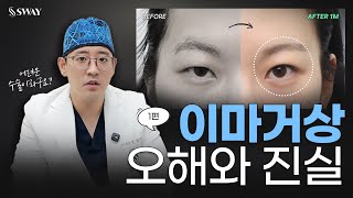 이마거상 오해하고 있는 거라고? 진실은?(1편) | #이마거상 #강민석대표원장