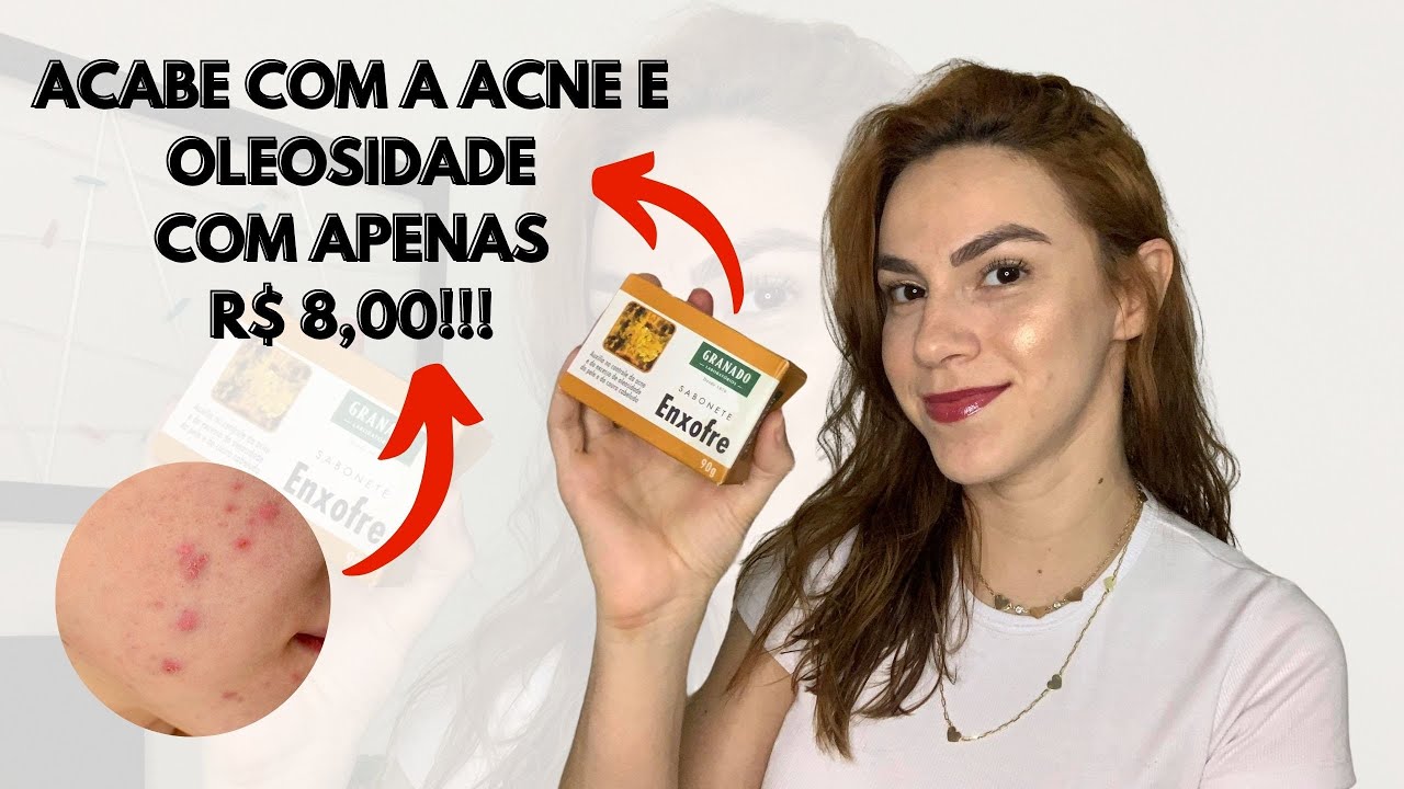 SABONETE DE ENXOFRE GRANADO | Como usar da maneira correta para acabar com a acne e oleosidade!